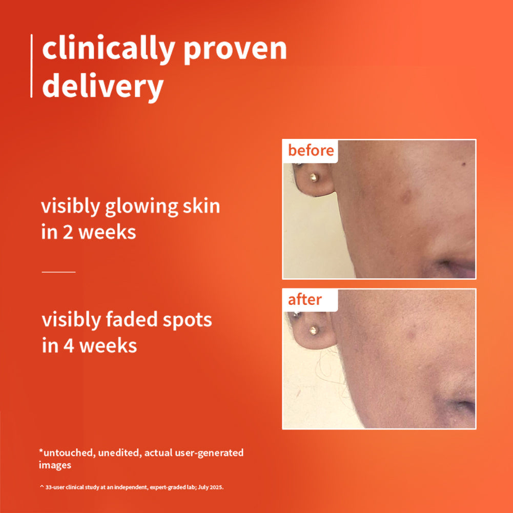 Plum 1% Vitamin C Ultra-Light-Glow Boosting Gel Cream with Alpha Arbutin | Boosts Glow | Fades Dark Spots & Pigmentation | Deeply Hydrates, 50g