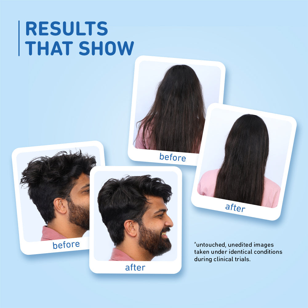 Plum Coconut Milk & Peptides Shampoo | Softens Strands | Nourishes Hair, 500ml