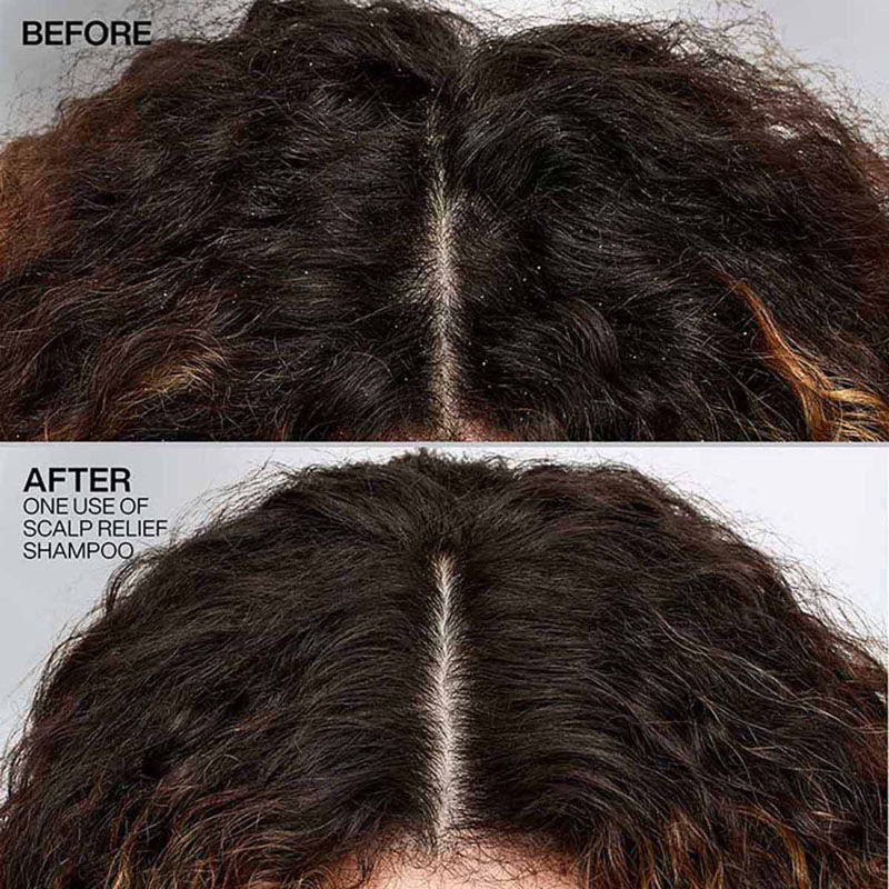 Redken Scalp Relief Anti Dandruff Shampoo For Men & Women, 250 g