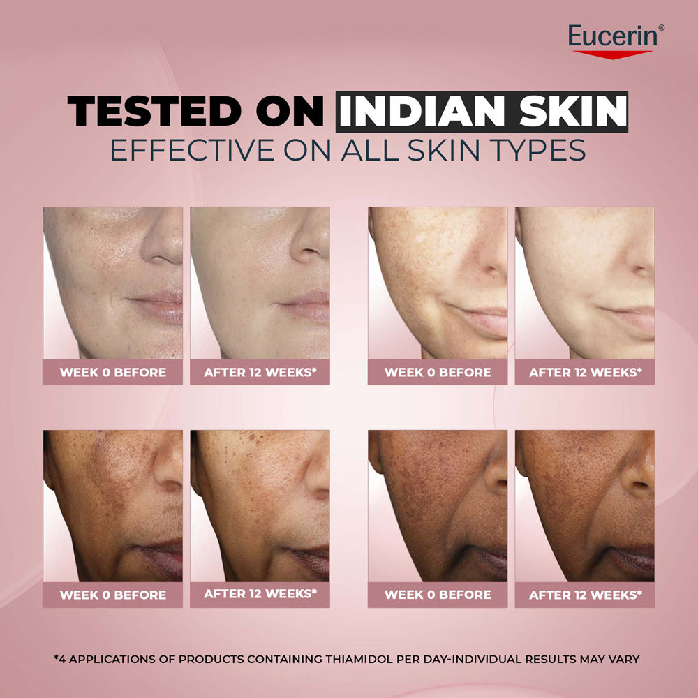 Eucerin Anti-Pigment Day Cream With Sunscreen SPF30 & Thiamidol Reduces And Prevents Dark Spots, 50ml