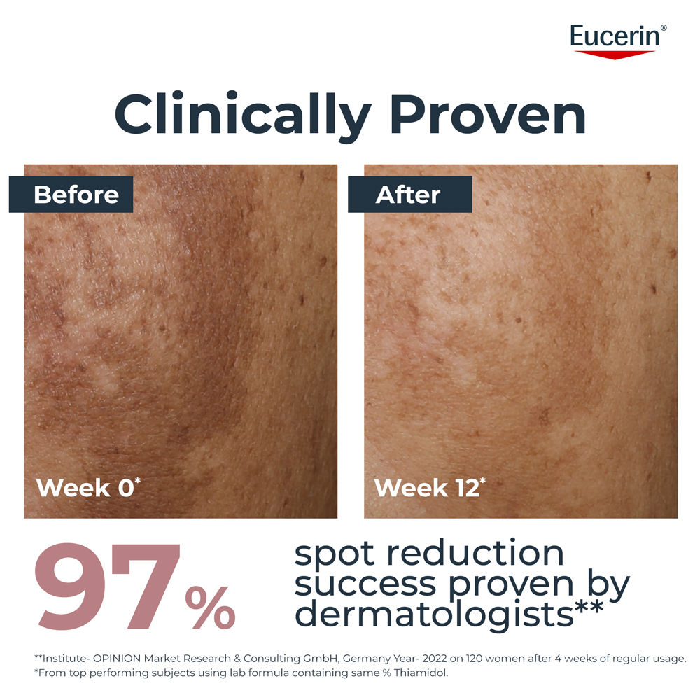 Eucerin Anti-Pigment Night Cream With Thiamidol Reduces Dark Spots & Night Regeneration, 50ml
