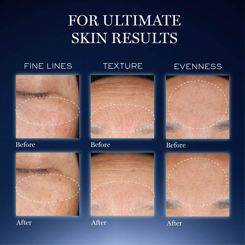 Lancome Genifique Ultimate Skin Repair Serum With Beta Glucan Suited for Indian Skin, 30ml