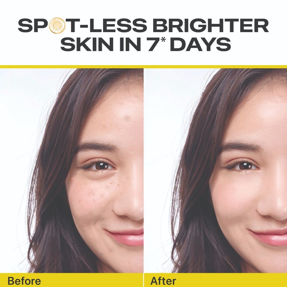 Nature's Essence V Bright Glow Vitamin C Face Serum, 30ml Buy at Indicrest Image 3