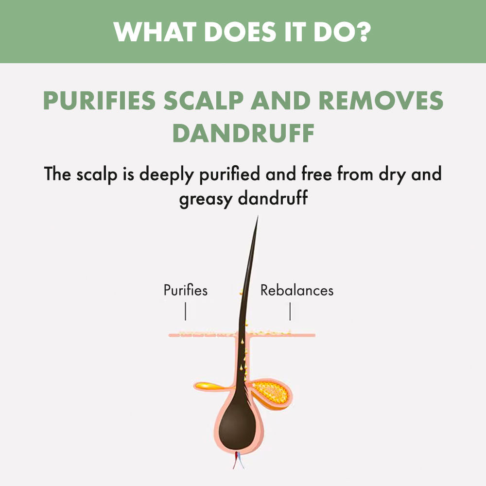 ALFAPARF MILANO Scalp Rebalance Exfoliating Scrub For Dandruff & Hairfall, Sulfate Free, 150ml