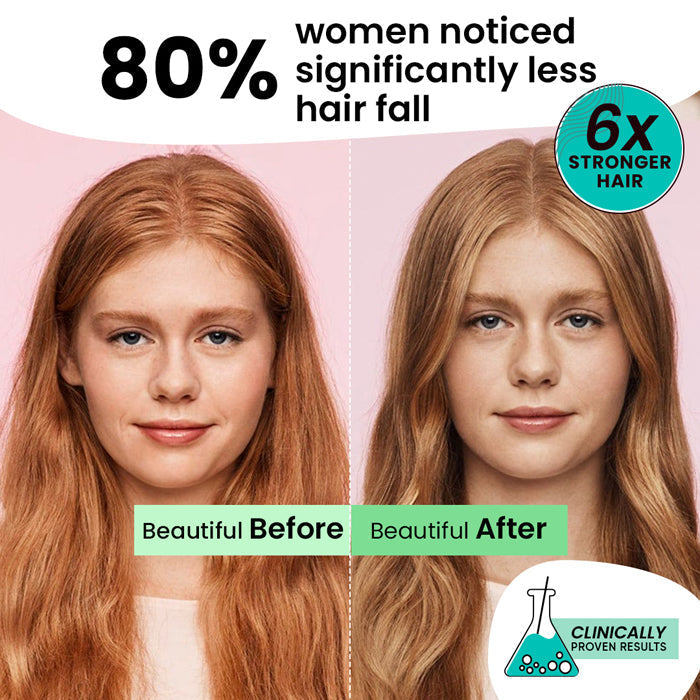 Dot & Key Moringa & Argan Oil Hair Fall Control Shampoo, 200ml