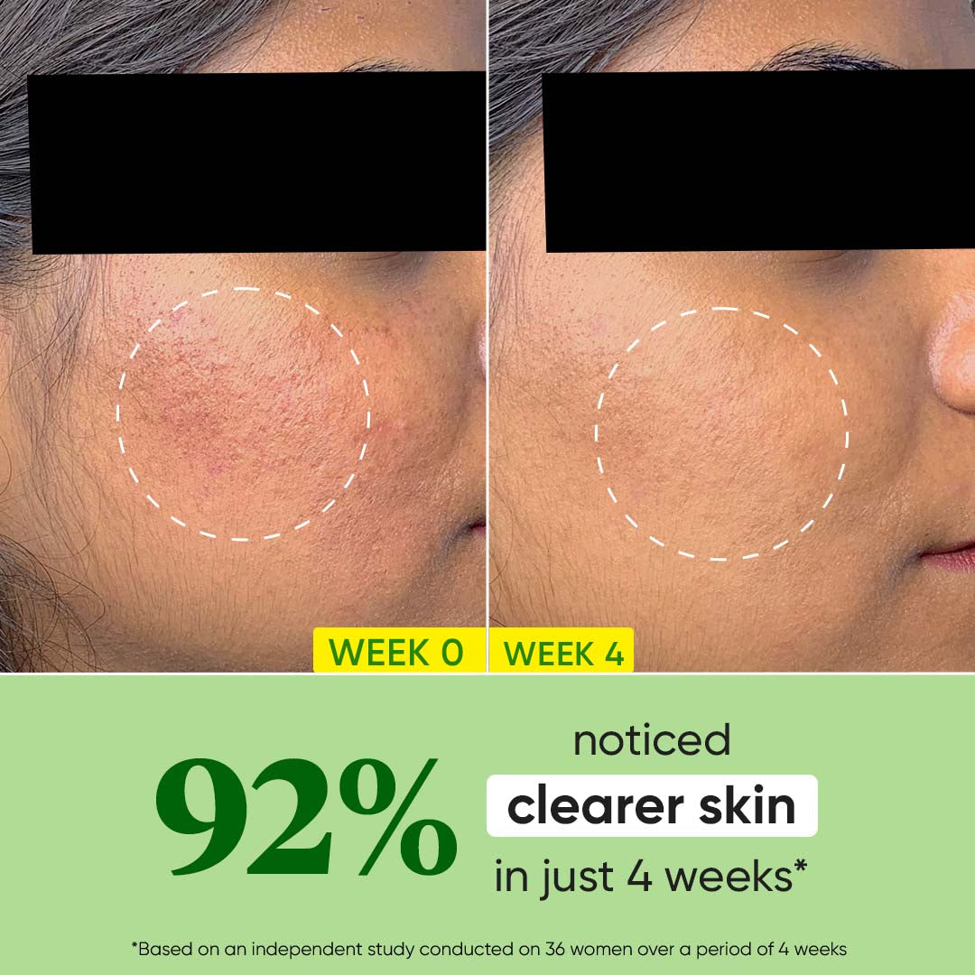 Dot & Key Cica Calming Oil Free Moisturize,Pack of 2 (60ml)