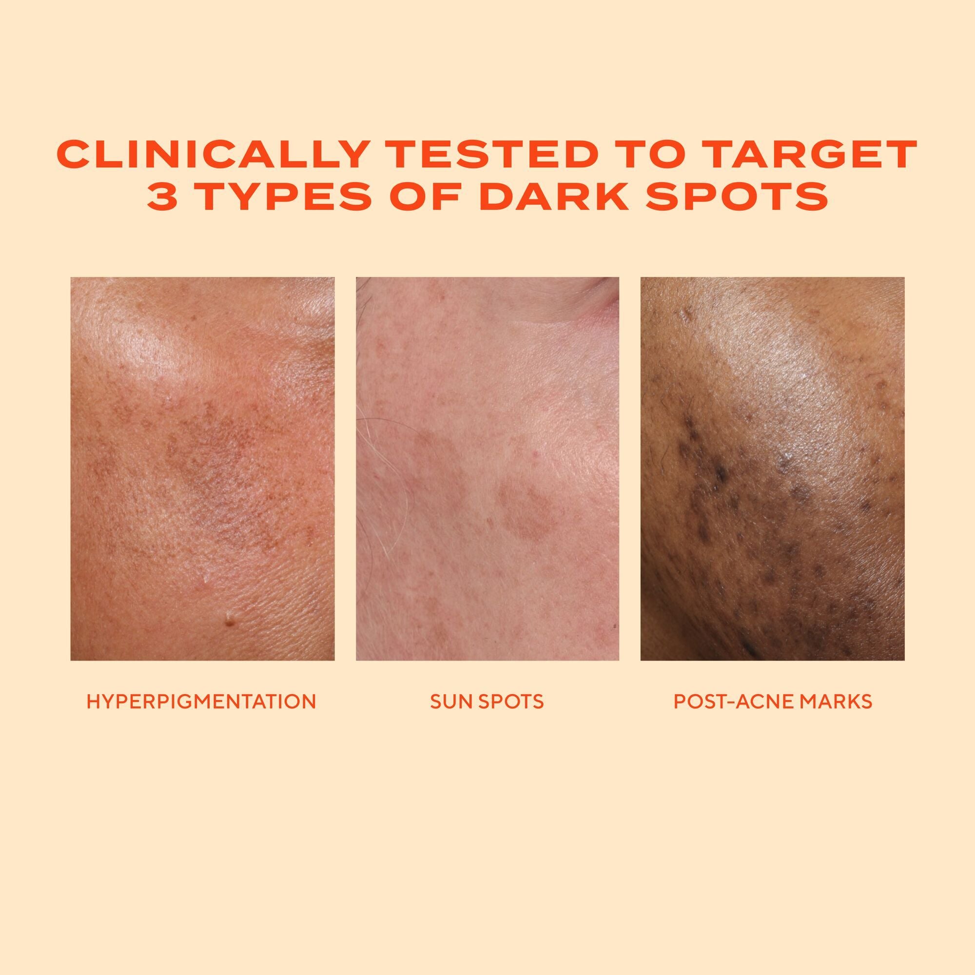 Murad Rapid Dark Spot Correcting Serum, 30ml