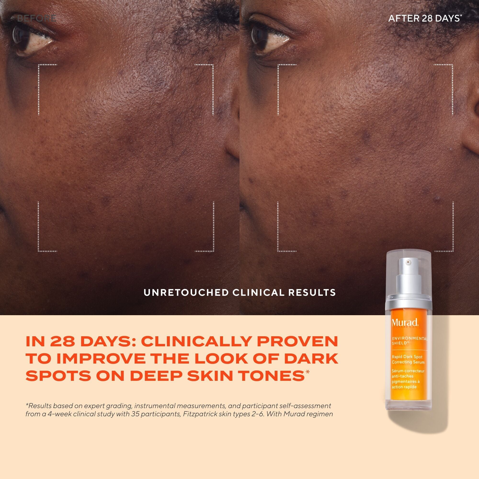 Murad Rapid Dark Spot Correcting Serum, 10ml