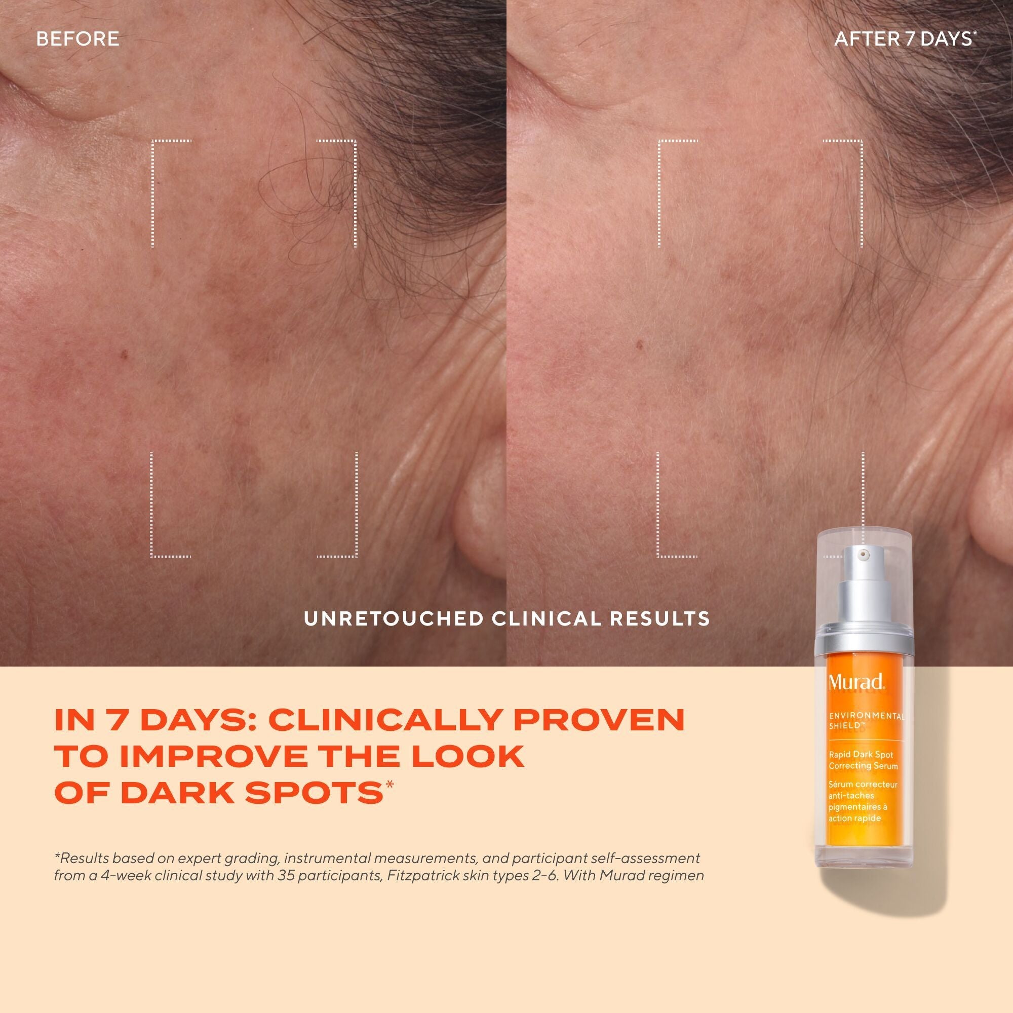Murad Rapid Dark Spot Correcting Serum, 10ml