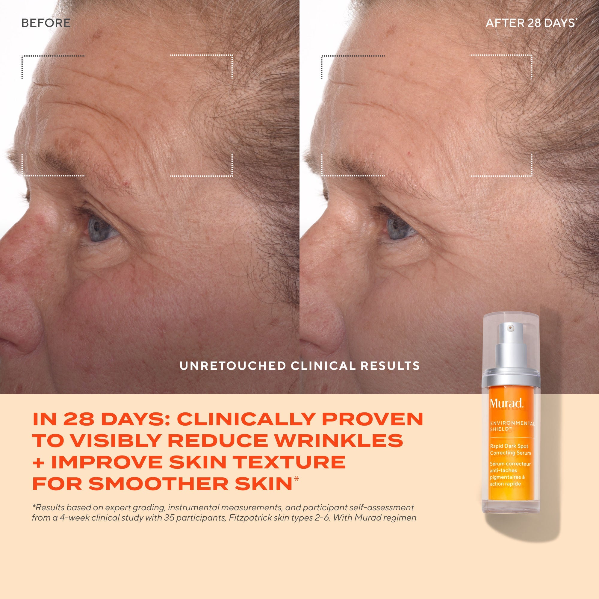 Murad Rapid Dark Spot Correcting Serum, 10ml