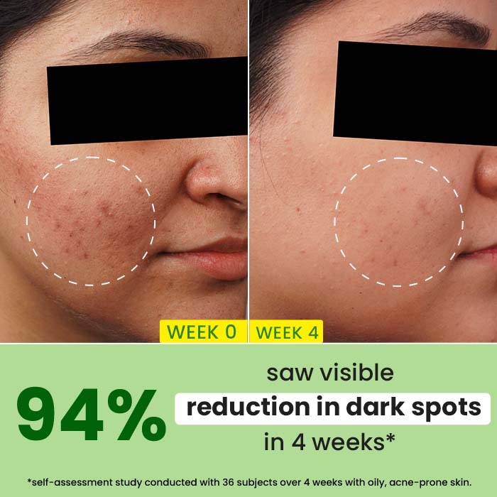 Dot & Key Cica + 10% Niacinamide Face Serum for Oily Skin, 20ml