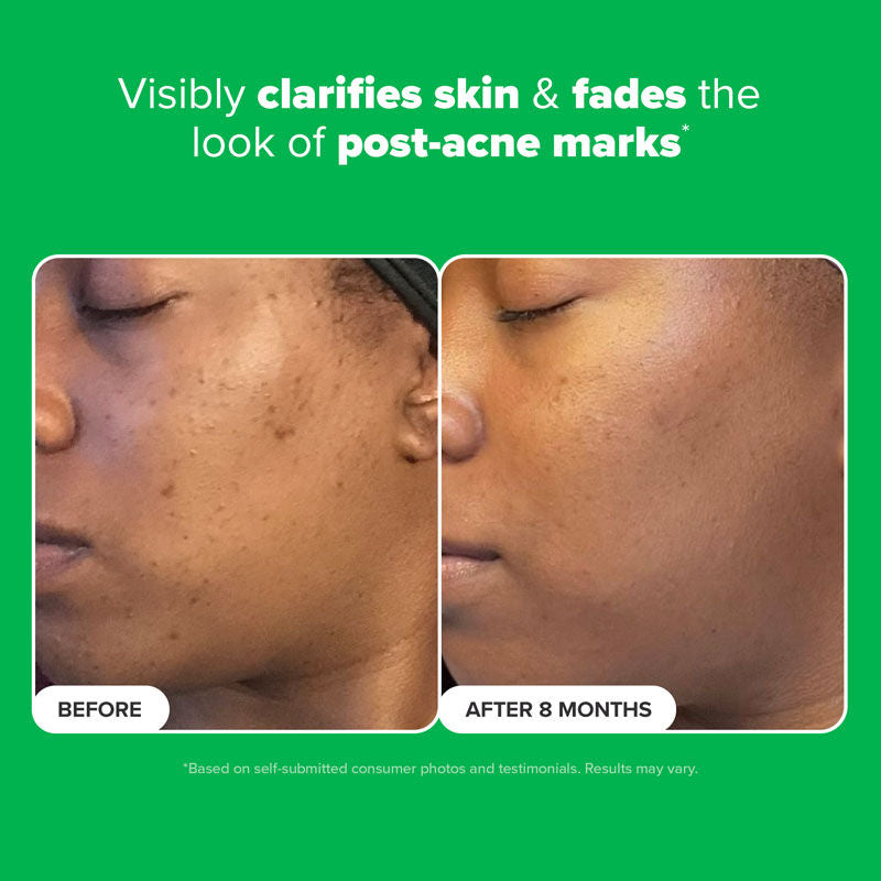 Paula's Choice Boost 10% Azelaic Acid Booster, 30ml