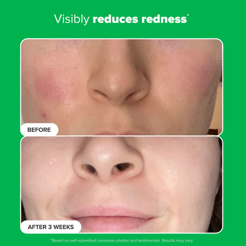 Paula's Choice Boost 10% Azelaic Acid Booster, 30ml