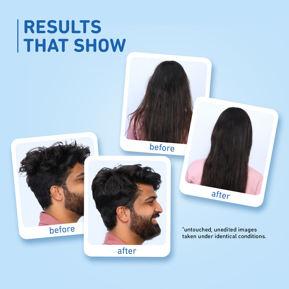 Plum Coconut Milk & Peptides Shampoo | Softens Strands | Nourishes Hair, 500ml