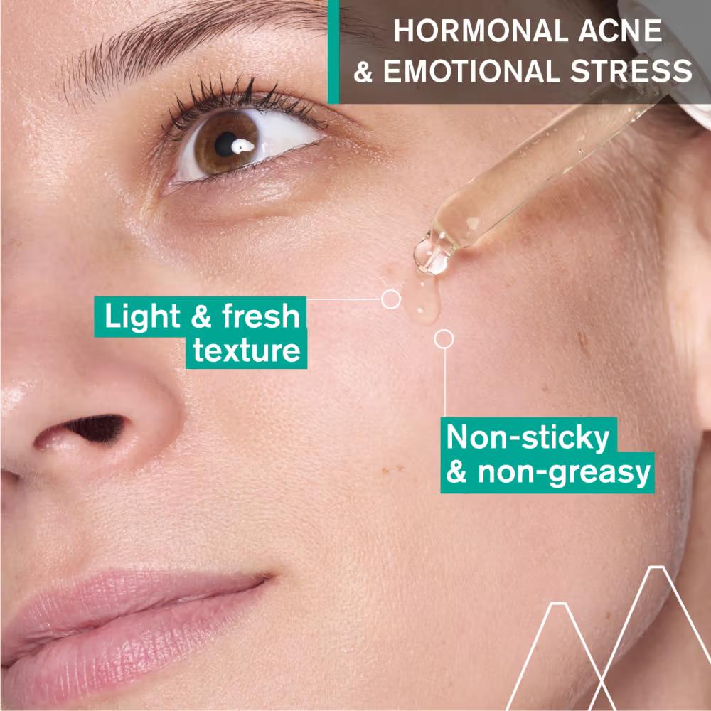 Uriage Hyseac Skin Anti-Blemish Serum 5.8% AHA for Hormonal Peak & Stress Acne Dermat Recommended, 30ml