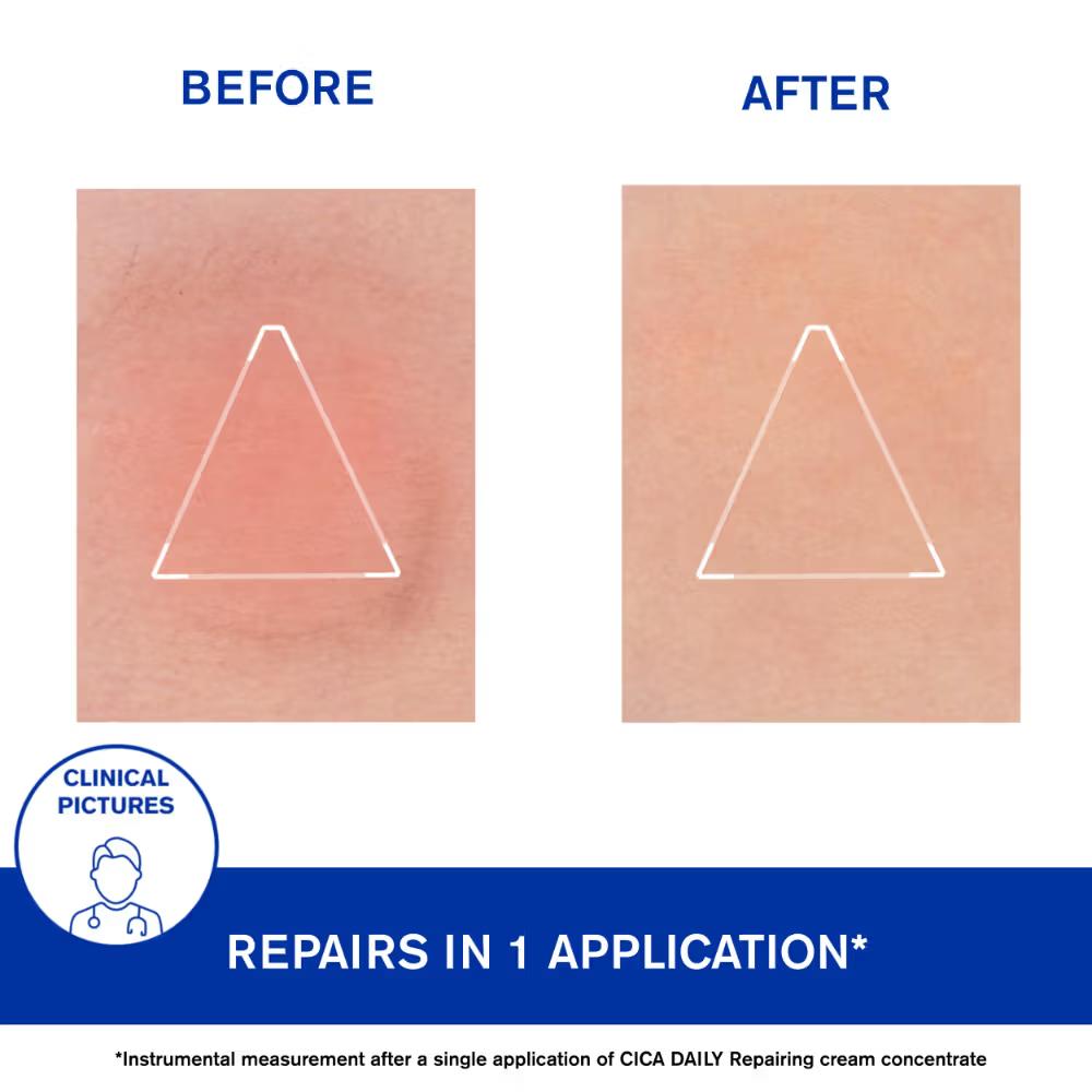 Uriage Cica-Daily Repairing Gel Face Cream Rejuvenates Skin Centella Asiatica Hyaluronic Acid Cu-Zn, 40ml