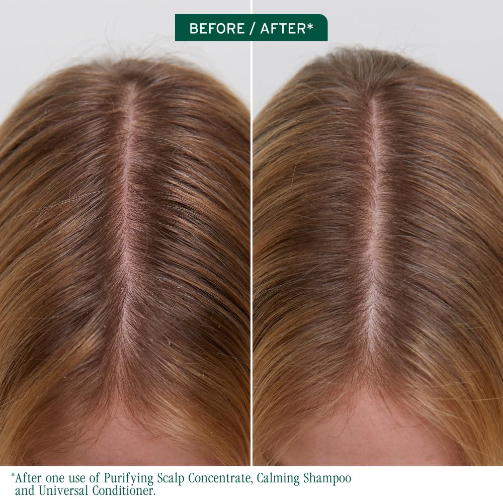 Matrix Biolage Scalp Sync Purifying Concentrate, 200ml Buy at Indicrest Image 6