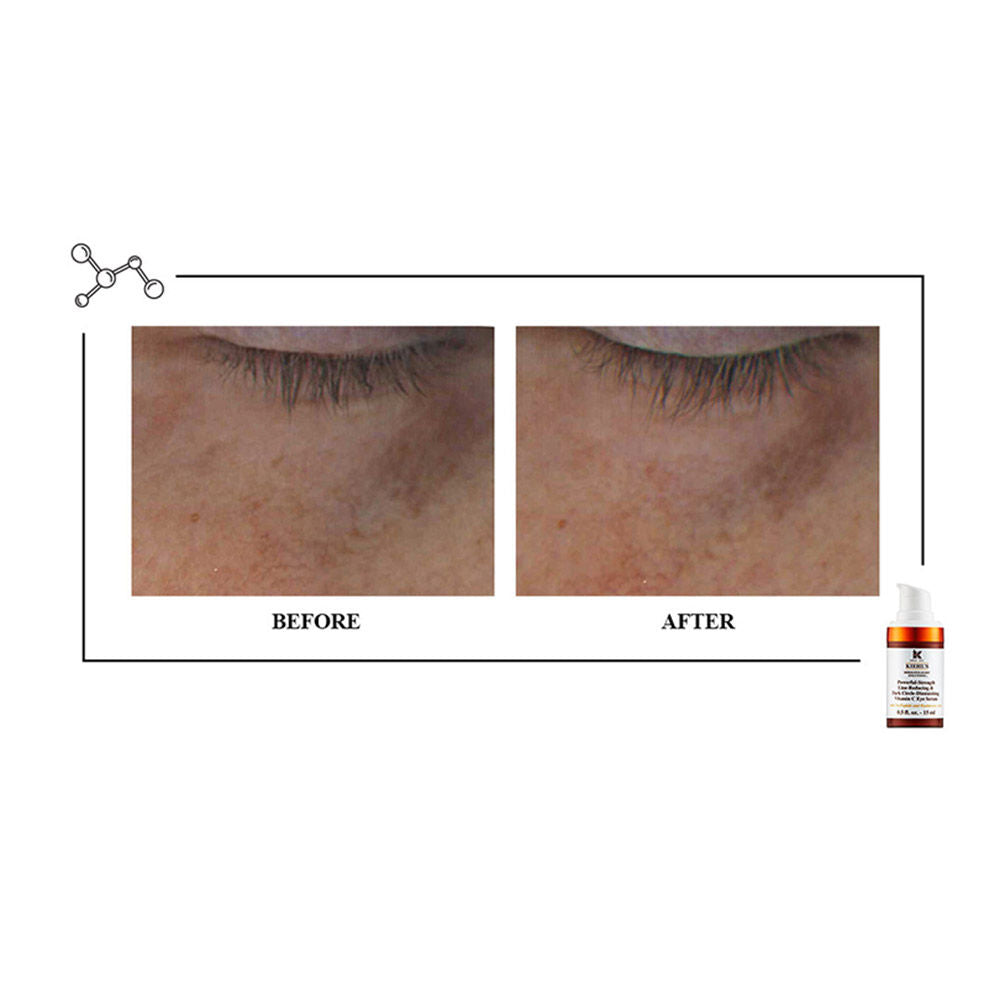 Kiehl's Powerful - Strength Line - Reducing & Dark Circle diminishing Vitamin C Eye Serum, 15ml