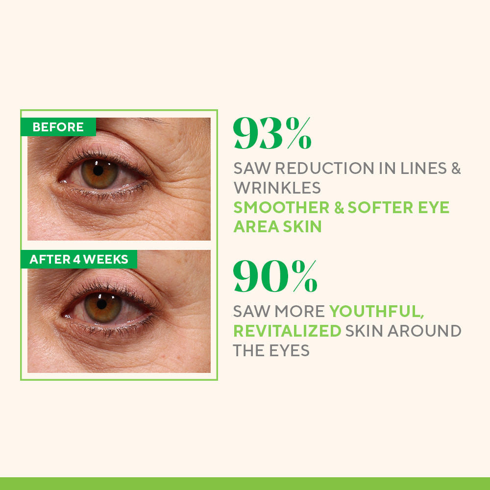 Murad Retinol Youth Renewal Eye Serum, 15ml