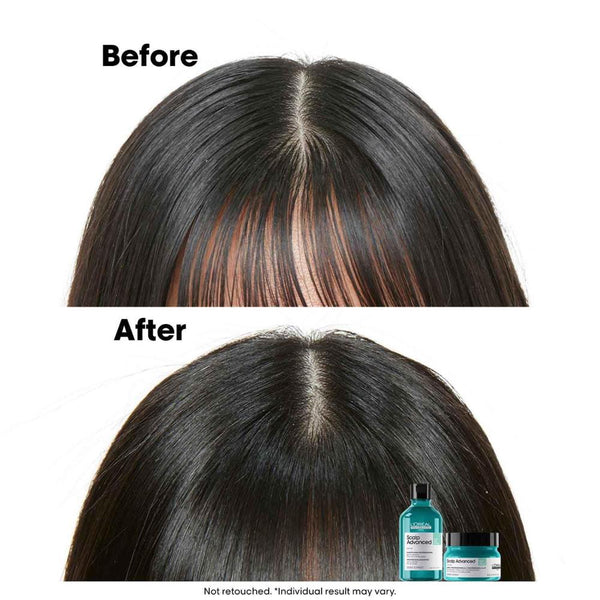Dermo-purifier shampoo for oily scalp