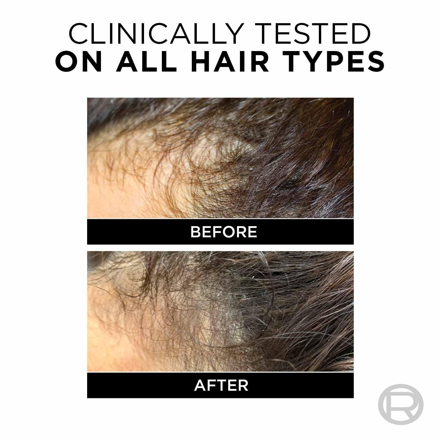 L'Oreal Paris Fall Resist 3X Anti-Hair Fall Shampoo With Arginine 180ml4