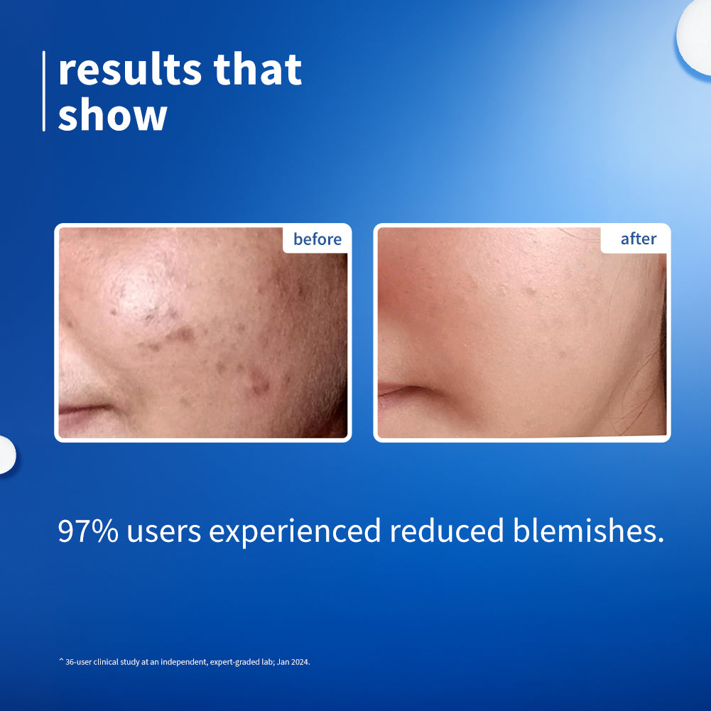 Plum 10% Niacinamide & Rice Water Brightening Face Serum | Brightens From 1st Use | 2X Instant Hydration | Dermat-Tested, 30ml