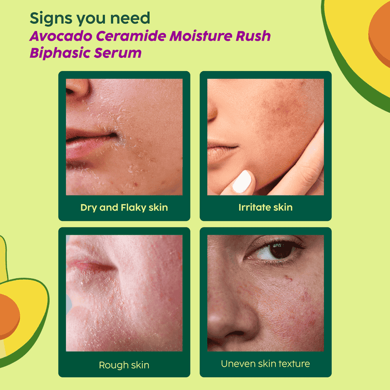 Plix Avocado Ceramide Moisture Rush Biphasic Serum for Strengthening Moisture Barrier, 30ml