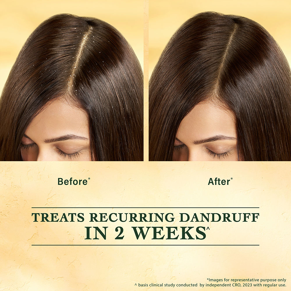 Indulekha Svetakutuja Dandruff Treatment Scalp Serum, 30ml Buy at Indicrest Image 9