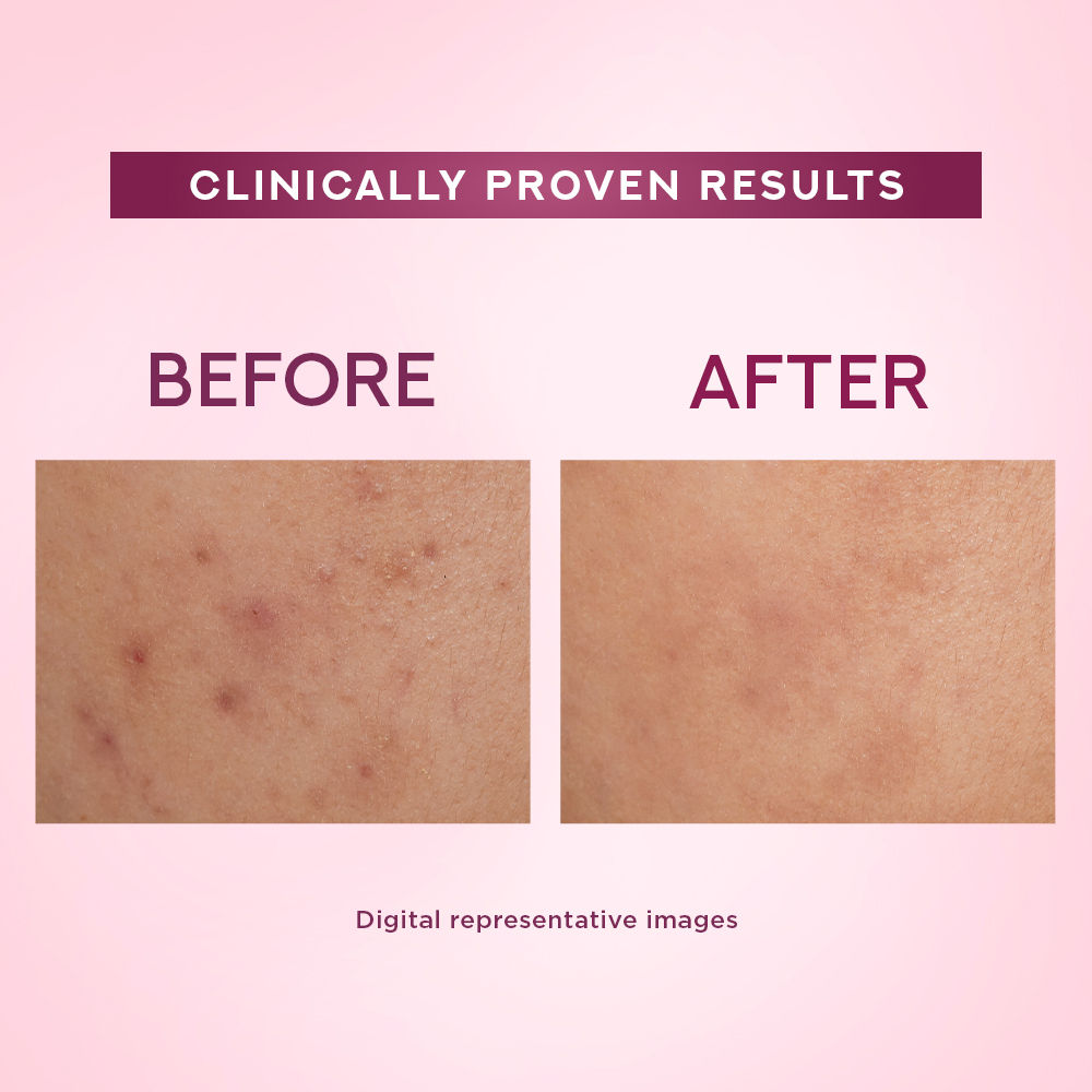 Pond’s Bright Beauty Serum Cream Spot-Less Glow SPF 15 PA++, 34g Buy at Indicrest Image 4