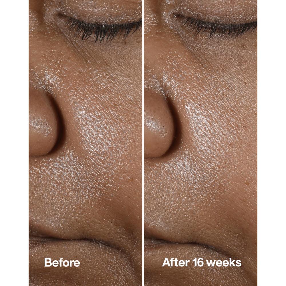 Clinique Smart Clinical Repair Wrinkle Correcting Serum With Retinoid, 50ml