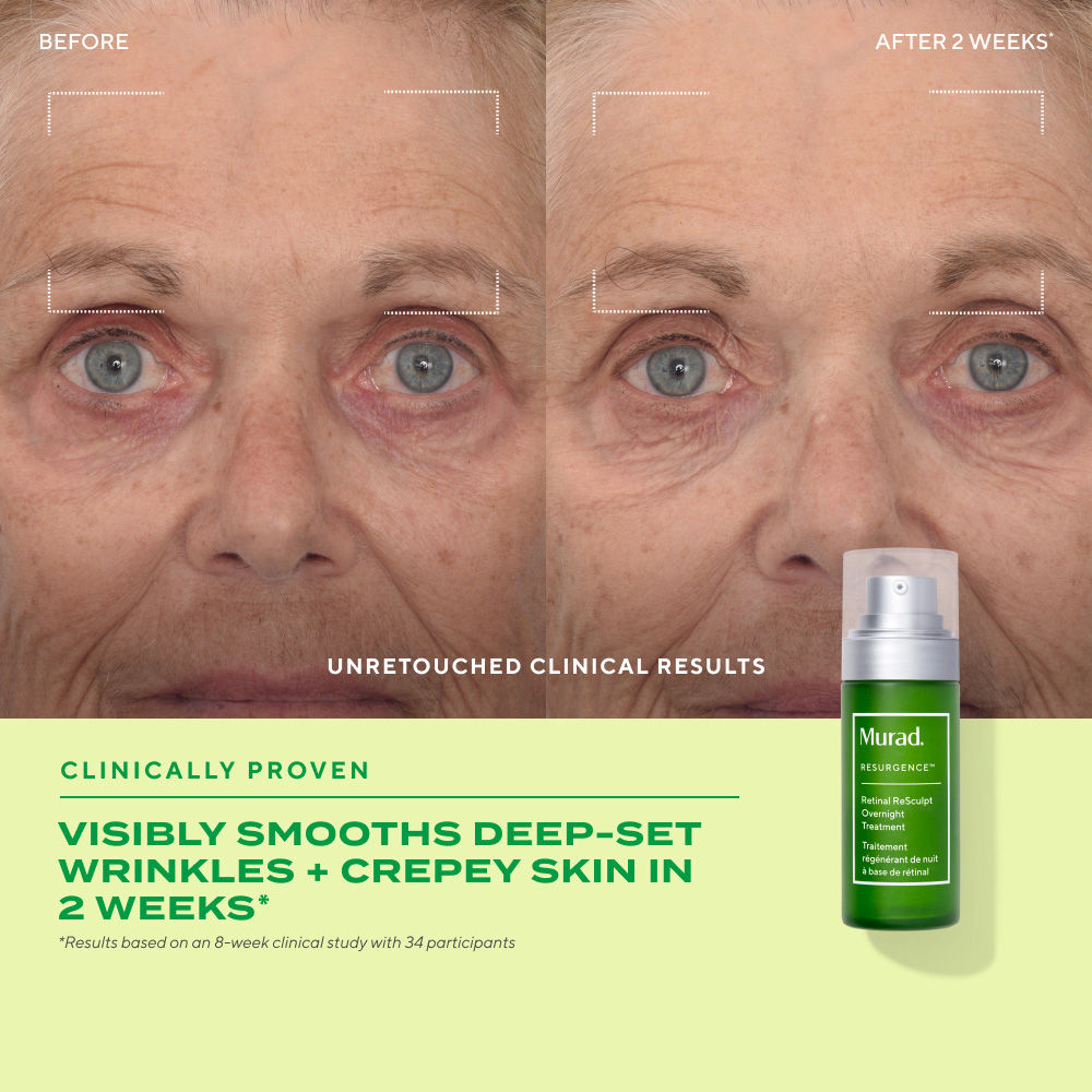 Murad Retinal ReSculpt Overnight Treatment, 30ml